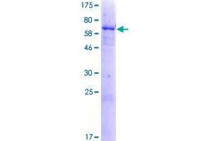 DHRS13 Protein (AA 1-327) (GST tag)