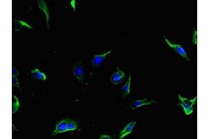 Immunofluorescent analysis of Hela cells using ABIN7154826 at dilution of 1:100 and Alexa Fluor 488-congugated AffiniPure Goat Anti-Rabbit IgG(H+L) (TSC1 antibody  (AA 101-344))