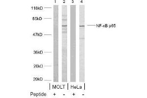 Image no. 1 for anti-Nuclear Factor-kB p65 (NFkBP65) (Ser468) antibody (ABIN197115) (NF-kB p65 antibody  (Ser468))