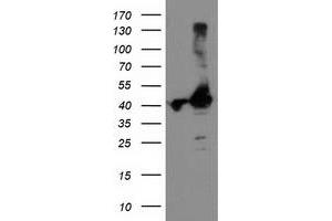 HEK293T cells were transfected with the pCMV6-ENTRY control (Left lane) or pCMV6-ENTRY TBC1D21 (Right lane) cDNA for 48 hrs and lysed. (TBC1D21 antibody)