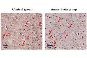 Staining Methods (StM) image for anti-CD63 (CD63) (AA 120-175) antibody (ABIN1440014)