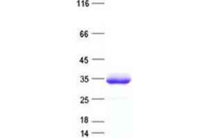 Validation with Western Blot (PRSS3 Protein (His tag))