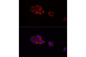 Immunofluorescence analysis of HepG2 cells using Perilipin-2 antibody (ABIN7269220) at dilution of 1:100 (40x lens). (ADRP antibody)