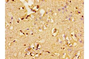 Immunohistochemistry of paraffin-embedded human brain tissue using ABIN7143338 at dilution of 1:100 (ADCY8 antibody  (AA 534-670))