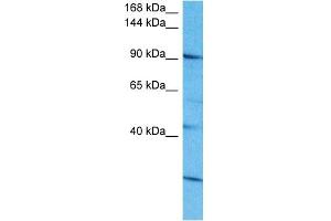 Host:  Rabbit  Target Name:  SALL4  Sample Tissue:  Human 721_B Whole Cell  Antibody Dilution:  1ug/ml (SALL4 antibody  (N-Term))