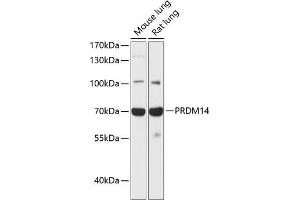 Western blot analysis of extracts of various cell lines, using PRDM14 antibody (ABIN6128495, ABIN6146132, ABIN6146135 and ABIN6217736) at 1:1000 dilution.