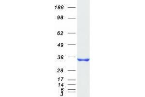 Validation with Western Blot