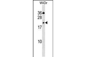 Western blot analysis in WiDr cell line lysates (35ug/lane). (CLEC2D antibody  (AA 109-137))