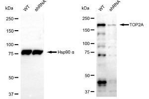 Western blotting analysis using TOP2A antibody (ABIN7800573). (Topoisomerase II alpha antibody)