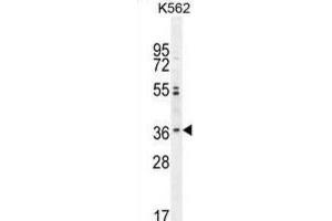 Western Blotting (WB) image for anti-Olfactory Receptor, Family 2, Subfamily M, Member 3 (OR2M3) antibody (ABIN2995886) (OR2M3 antibody)