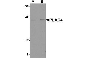 Western Blotting (WB) image for anti-Placenta-Specific 4 (PLAC4) (Middle Region) antibody (ABIN1031043) (PLAC4 antibody  (Middle Region))