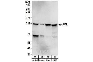 Western Blotting (WB) image for anti-ATP Citrate Lyase (ACLY) (AA 1051-1101) antibody (ABIN7452922) (ACLY antibody  (AA 1051-1101))