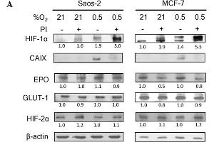 Bortezomib attenuates HIF-1 but not HIF-2 transcriptional activity. (EPAS1 antibody)