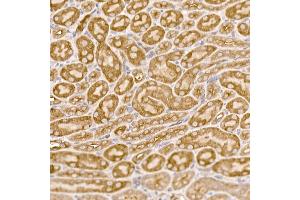 Immunohistochemistry (IHC) image for anti-Numb Homolog (NUMB) (AA 521-640) antibody (ABIN6144943)