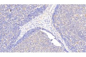 Immunohistochemistry (IHC) image for anti-Nuclear Factor of kappa Light Polypeptide Gene Enhancer in B-Cells Inhibitor, epsilon (NFKBIE) (AA 207-440) antibody (ABIN7439441)