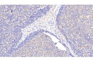 Detection of IkBe in Human Lymph node Tissue using Polyclonal Antibody to Inhibitory Subunit Of NF Kappa B Epsilon (IkBe) (Inhibitory Subunit of NF-KappaB epsilon (AA 207-440) antibody)