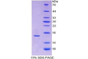 SDS-PAGE analysis of Human RXFP1 Protein. (Relaxin/insulin-Like Family Peptide Receptor 1 (RXFP1) Peptide)