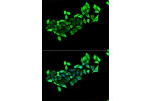 Immunofluorescence analysis of HeLa cells using FLOT1 antibody (ABIN5973661). (Flotillin 1 antibody)