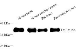 Western blot analysis of TMEM156 (ABIN7075992) at dilution of 1: 2000 (TMEM156 antibody)