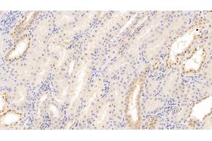 Detection of MIg in Human Kidney Tissue using Monoclonal Antibody to Monokine Induced By Interferon Gamma (MIg) (CXCL9 antibody)