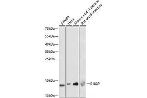 Western blot analysis of extracts of various cell lines using S100P Polyclonal Antibody at dilution of 1:1000. (S100P antibody)