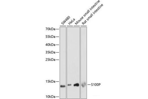 S100P antibody