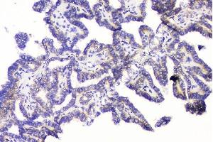 IHC analysis of RRBP1 using anti-RRBP1 antibody (ABIN6719628). (RRBP1 antibody)