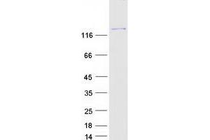 Validation with Western Blot (Phospholipase C gamma 1 Protein (Transcript Variant 1) (Myc-DYKDDDDK Tag))