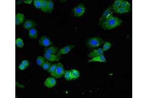 Immunofluorescent analysis of HepG2 cells using ABIN7151564 at dilution of 1:100 and Alexa Fluor 488-congugated AffiniPure Goat Anti-Rabbit IgG(H+L) (ELOVL4 antibody  (AA 270-314))