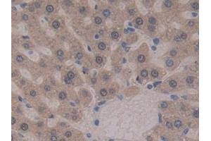 Detection of GSTt2 in Rat Liver Tissue using Polyclonal Antibody to Glutathione S Transferase Theta 2 (GSTt2) (GSTT2 antibody  (AA 16-242))