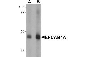 Western blot analysis of EFCAB4A in human lung tissue lysate with EFCAB4A antibody at (A) 1 and (B) 2 µg/mL. (EFCAB4A antibody  (Middle Region))