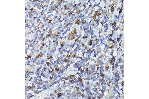 Immunohistochemistry of paraffin-embedded human tonsil using Smad2 Rabbit pAb (ABIN1513537, ABIN3020986, ABIN3020987 and ABIN1514681) at dilution of 1:100 (40x lens).