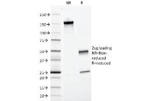 SDS-PAGE (SDS) image for anti-Epithelial Cell Adhesion Molecule (EPCAM) (AA 77-202), (Extracellular Domain) antibody (ABIN6939977)
