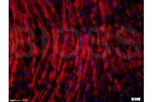 Formalin-fixed and paraffin embedded: rat brain tissue labeled with Anti-Glucocorticoid receptor(GR) Polyclonal Antibody, Unconjugated (ABIN726875) at 1:200,, followed by conjugation to the secondary antibody was Goat Anti-Rabbit IgG, PE conjugated at 1:200 for 40 minutes at 37°C (Glucocorticoid Receptor antibody  (AA 231-320))