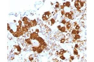 IHC testing of FFPE human pituitary gland with ACTH antibody (clone CLIP/1407). (CLIP antibody  (AA 25-39))