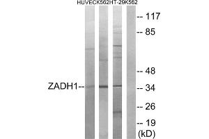 Western blot analysis of extracts from HUVEC cells, K562 cells and HT-29 cells, using ZADH1 antibody. (PTGR2 antibody  (Internal Region))