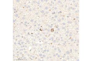 Immunohistochemistry of paraffin embedded mouse liver using RAB21 (ABIN7075341) at dilution of 1: 700 (300x lens) (RAB21 antibody)