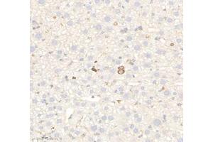 Immunohistochemistry of paraffin embedded mouse liver using RAB21 (ABIN7075341) at dilution of 1: 700 (300x lens) (RAB21 antibody)
