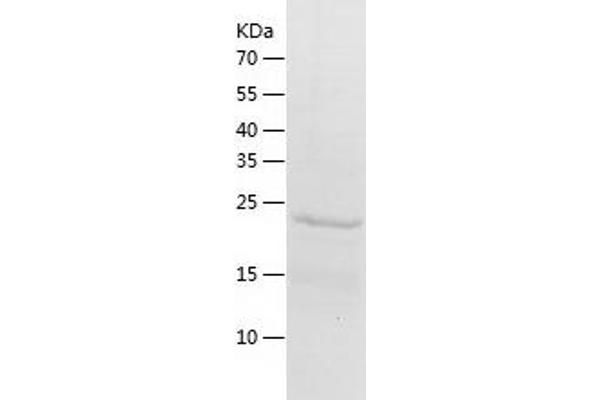 PSME1 Protein (AA 1-249) (His tag)