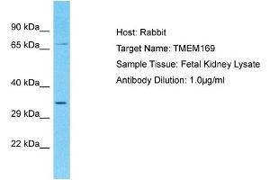 Host: Rabbit Target Name: TMEM169 Sample Type: Fetal Kidney lysates Antibody Dilution: 1. (TMEM169 antibody  (C-Term))
