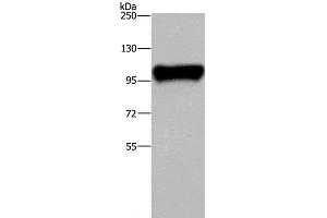 Western Blot analysis of Raji cell using PTK2B Polyclonal Antibody at dilution of 1:300 (PTK2B antibody)