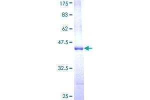 TRIM5 Protein (AA 309-418) (GST tag)