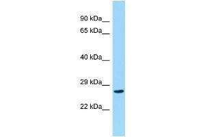 Host: Rabbit Target Name: CCDC28B Sample Type: Hela Whole cell lysates Antibody Dilution: 1. (CCDC28B antibody  (C-Term))