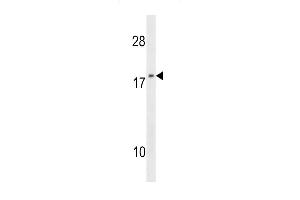NME1 Antibody (F40) (ABIN392655 and ABIN2842156) western blot analysis in 293 cell line lysates (35 μg/lane).