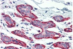 Human Breast (formalin-fixed, paraffin-embedded) stained with DLG4 antibody ABIN396947 at 5 ug/ml followed by biotinylated goat anti-rabbit IgG secondary antibody ABIN481713, alkaline phosphatase-streptavidin and chromogen. (DLG4 antibody  (C-Term))