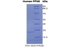 SDS-PAGE analysis of Human Profilin 2 Protein. (PFN2 Protein)
