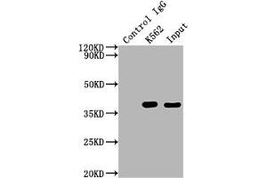 Immunoprecipitating CDK6 in K562 whole cell lysate Lane 1: Rabbit control IgG instead of ABIN7127420 in K562 whole cell lysate. (Recombinant CDK6 antibody)