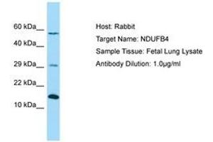 Image no. 1 for anti-NADH Dehydrogenase (Ubiquinone) 1 beta Subcomplex, 4, 15kDa (NDUFB4) (AA 71-120) antibody (ABIN6750060) (NDUFB4 antibody  (AA 71-120))