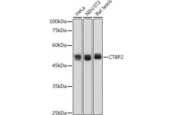 CTBP2 antibody