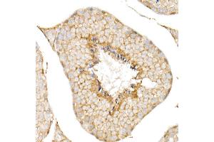 Immunohistochemistry of paraffin-embedded human liver using CD81 Rabbit pAb (ABIN6134776, ABIN6138231, ABIN6138232 and ABIN6220897) at dilution of 1:50 (40x lens). (CD81 antibody  (AA 1-100))